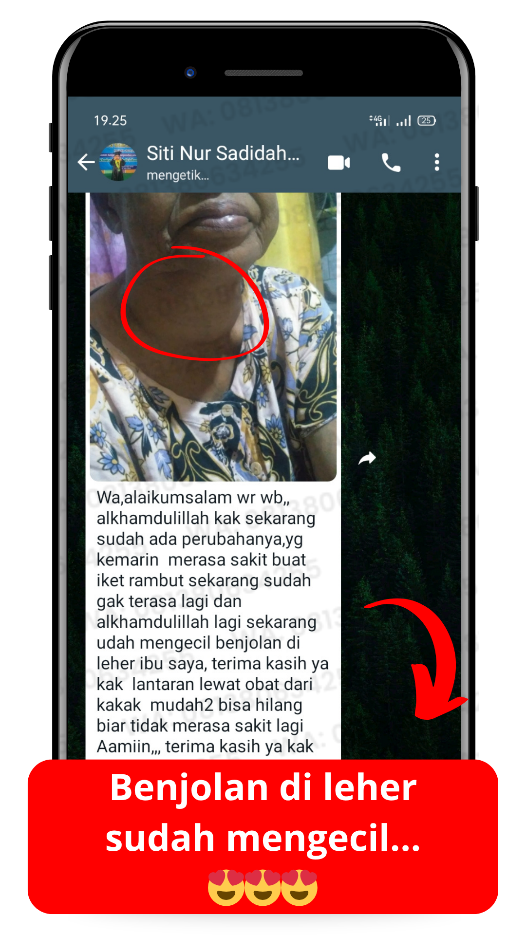 Dokumentasi testimoni pelanggan Oilife 5